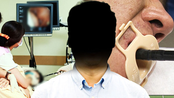 지병 없었는데 왜&hellip;수면 위내시경 받다 '뇌사 사망'
