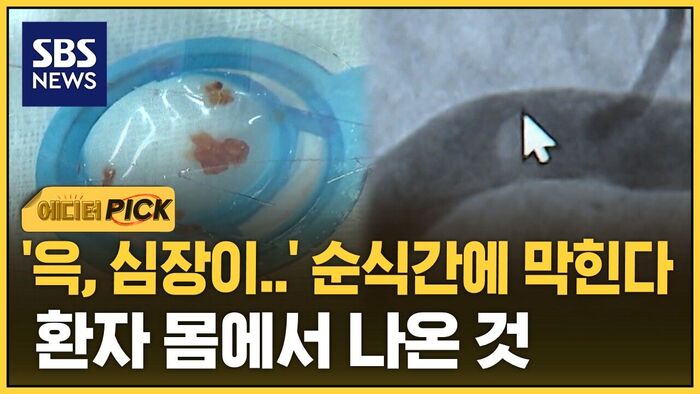 [에디터픽] 더울수록 '급증'&hellip;탈수 일어나면 "순식간에 막혀"