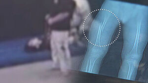 Exclusive: Another Child Abuse Allegation at Taekwondo Gym... 7-Year-Old Suffers Fractured Leg During Forced Splits