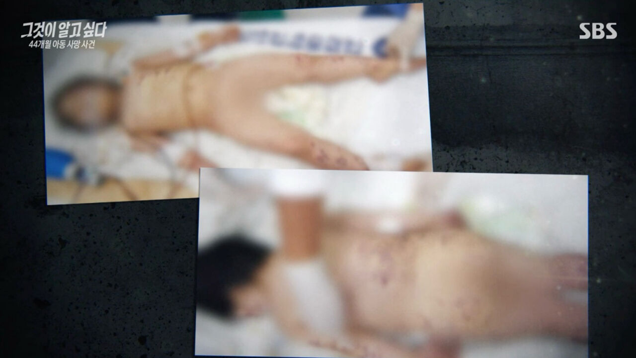 '그알' 생후 44개월 아동 사망 사건1