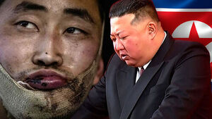 Bandaged Face of Captured N. Korean Soldier Tied to Kim Jong-un's "Suicide upon Capture" Order?