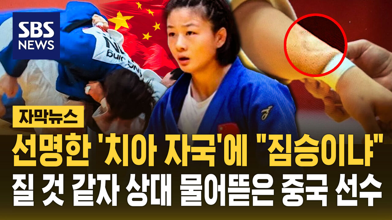 [자막뉴스] 선명한 '치아 자국'에 "짐승이냐"…질 것 같자 상대 물어뜯은 중국 선수