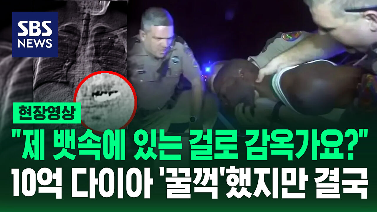 [현장영상] 10억 원 귀걸이 훔쳐 '꿀꺽'…완전 범죄 꿈꿨지만 '뱃속' 드러나자