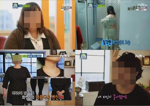 초고도 비만녀