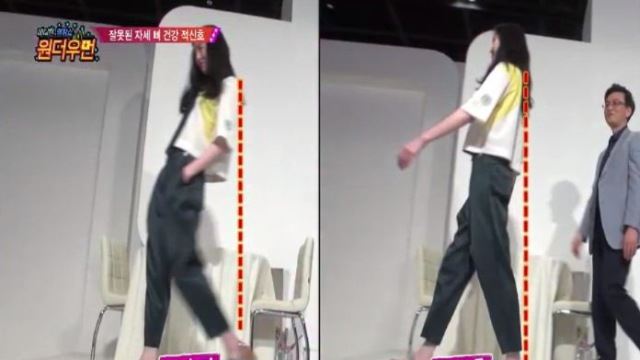 [영상] '원더우먼' 김새롬, '거북목 증후군' 진단?