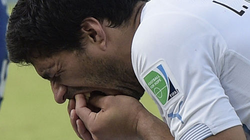 수아레스 핵이빨