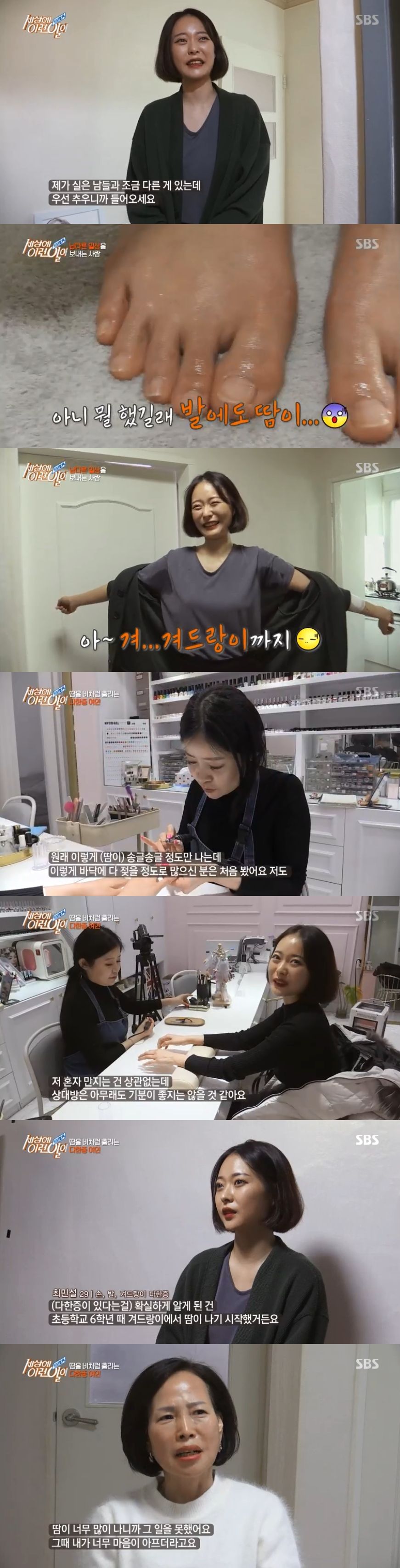 '세상에 이런일이' 땀이 비 오듯?…땀을 비처럼 흘리는 여성의 고충