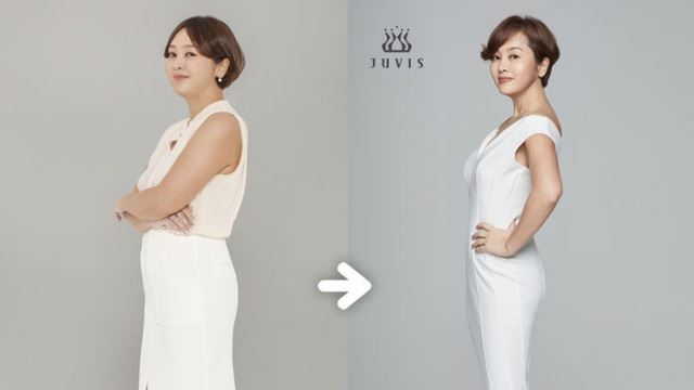 갑상선 기능 저하증 앓던 이승연, 두 달만에 9kg 감량 성공