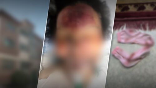 "재산 분배 불만에 형들이 폭행" vs "치매 때문에 자해"…'그알', 강남 수백억 자산가 사망 사건 추적