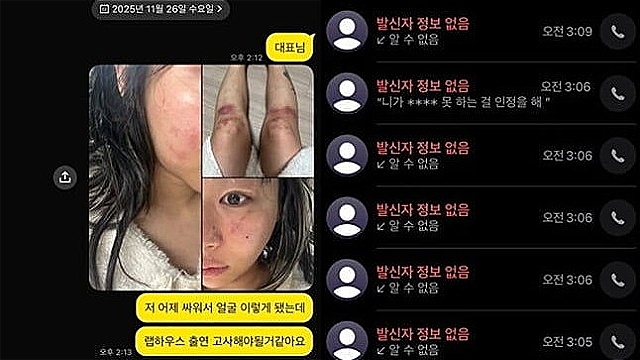 AOMG 래퍼 재키와이, 멍든 얼굴+무릎 공개...20일 만에 '데이트폭력' 수면 위로