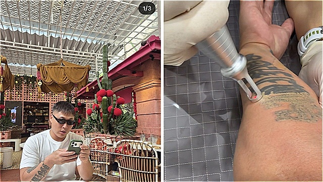 스윙스, 팔뚝 가득한 타투 제거…"이젠 배우 학도의 길 걷는다"