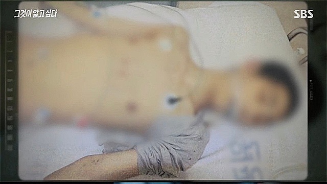 [스브스夜] '그알' 익산 의붓아들 학대 사망 사고&middot;&middot;&middot;그릇된 부성애 때문이라는 계부, 진실은?